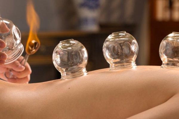 CuppingTherapy.jpg